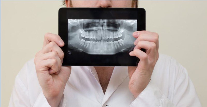 رادیوگرافی پری اپیکال دندان