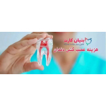 هزینه عصب کشی دندان