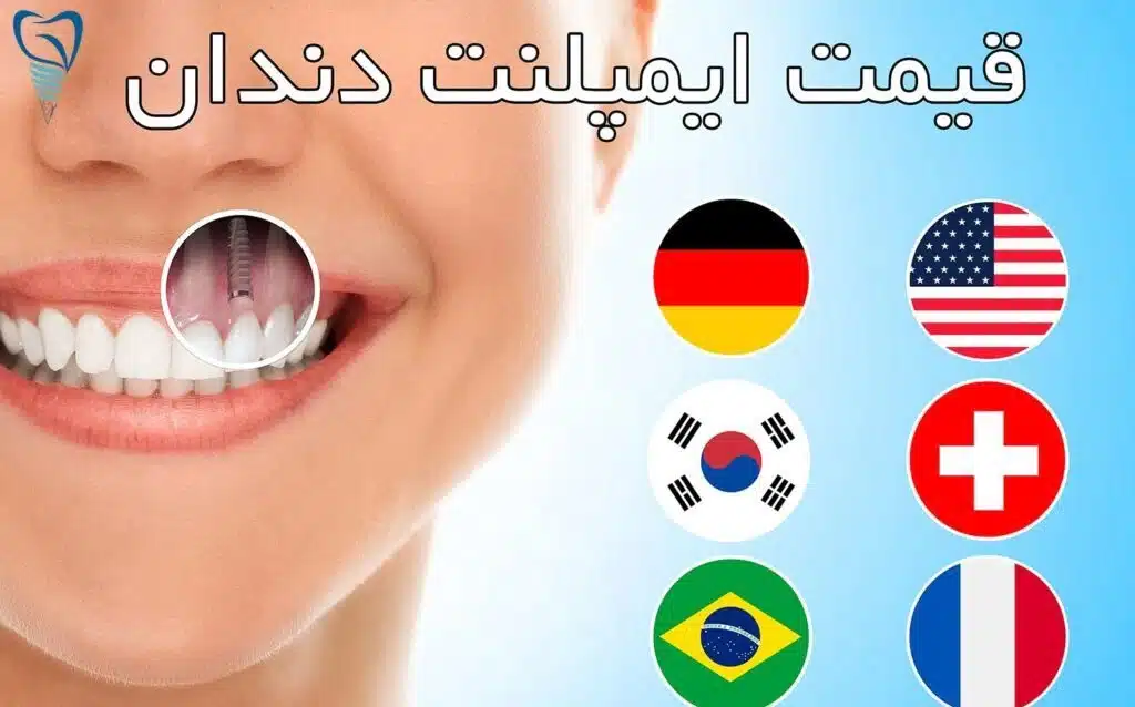 ایمپلنت دندان ارزان