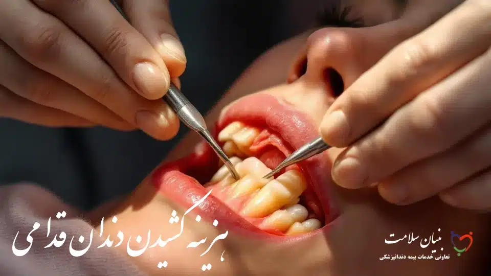 هزینه کشیدن دندان قدامی
